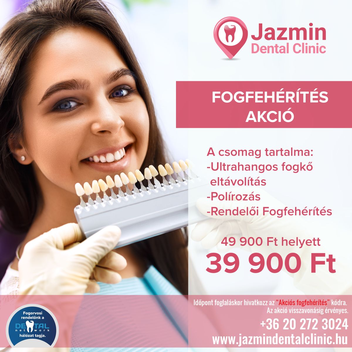 Fogfeh r t s akci Jazmin Dental Clinic Fog szat Budapest